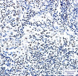 ZBTB7A Antibody in Immunohistochemistry (Paraffin) (IHC (P))
