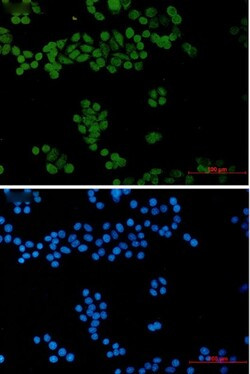GTF2I Antibody in Immunocytochemistry (ICC/IF)