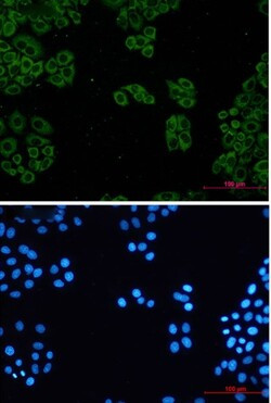 TCP1 Antibody in Immunocytochemistry (ICC/IF)