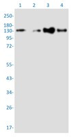 TACC3 Antibody in Western Blot (WB)