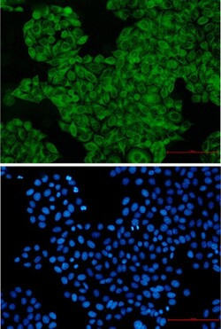 SNX1 Antibody in Immunocytochemistry (ICC/IF)