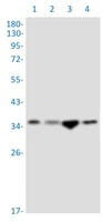 SRR Antibody in Western Blot (WB)