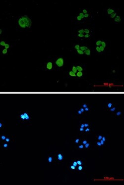 SBDS Antibody in Immunocytochemistry (ICC/IF)