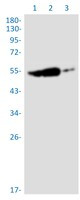 RGS6 Antibody in Western Blot (WB)