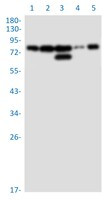 RANGAP1 Antibody in Western Blot (WB)