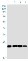 RAB29 Antibody in Western Blot (WB)