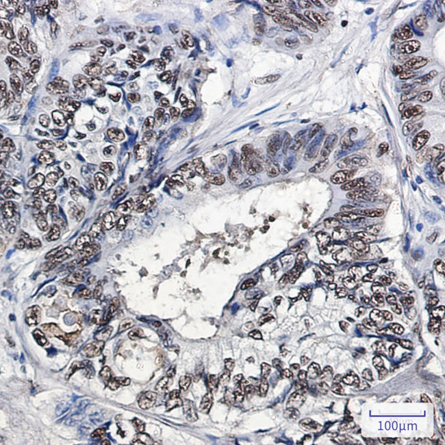 ANP32B Antibody in Immunohistochemistry (Paraffin) (IHC (P))