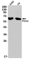 P4HB Antibody in Western Blot (WB)