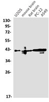 Phospho-PARVA (Ser8) Antibody in Western Blot (WB)