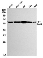 PAK2 Antibody in Western Blot (WB)