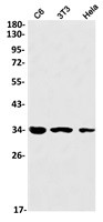 PRKRA Antibody in Western Blot (WB)