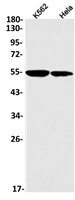 KATNA1 Antibody in Western Blot (WB)