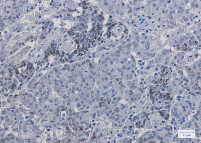 Phospho-CDKN1B (Ser10) Antibody in Immunohistochemistry (Paraffin) (IHC (P))