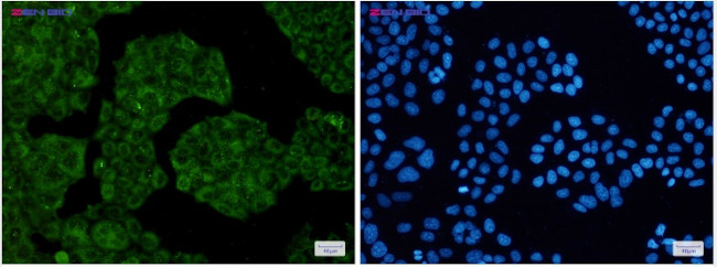 NUDT9 Antibody in Immunocytochemistry (ICC/IF)