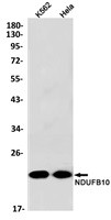 NDUFB10 Antibody in Western Blot (WB)
