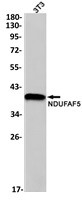 NDUFAF5 Antibody in Western Blot (WB)