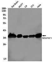 NDUFAF1 Antibody in Western Blot (WB)