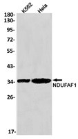 NDUFAF1 Antibody in Western Blot (WB)