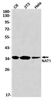 NAT1 Antibody in Western Blot (WB)