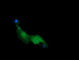RAB21 Antibody in Immunocytochemistry (ICC/IF)