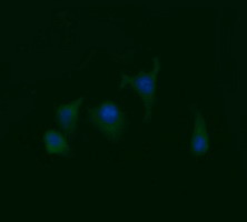 RAB21 Antibody in Immunocytochemistry (ICC/IF)
