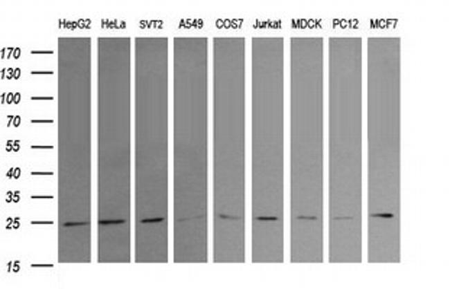 RAB21 Antibody in Western Blot (WB)