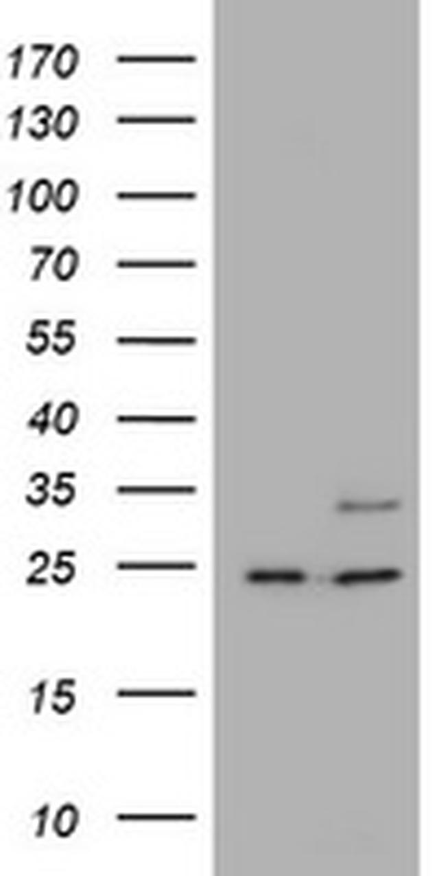 RAB21 Antibody in Western Blot (WB)