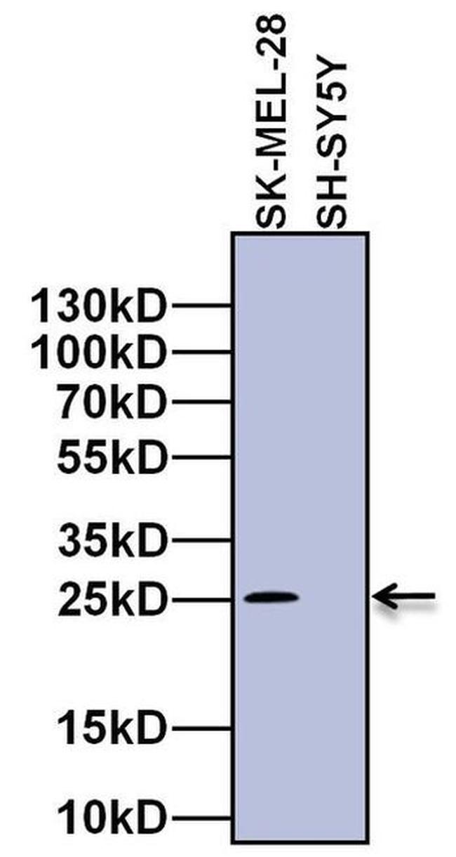 RAB27A Antibody in Western Blot (WB)