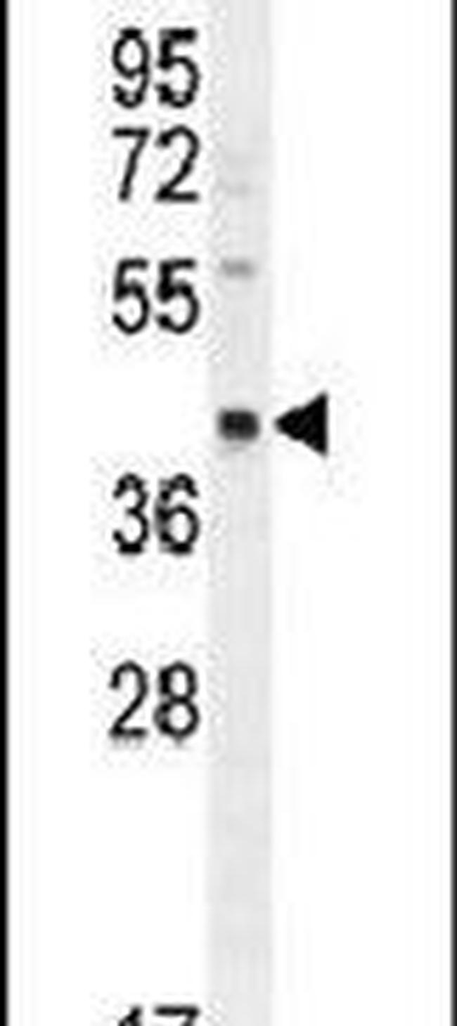 RAB3IL1 Antibody in Western Blot (WB)