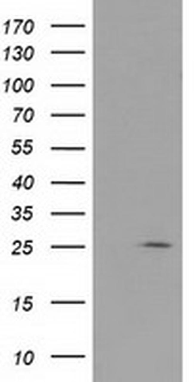 RABL2A Antibody in Western Blot (WB)