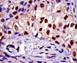 RAD23A Antibody in Immunohistochemistry (IHC)