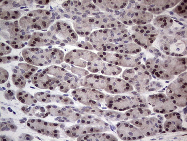 RAD23B Antibody in Immunohistochemistry (Paraffin) (IHC (P))