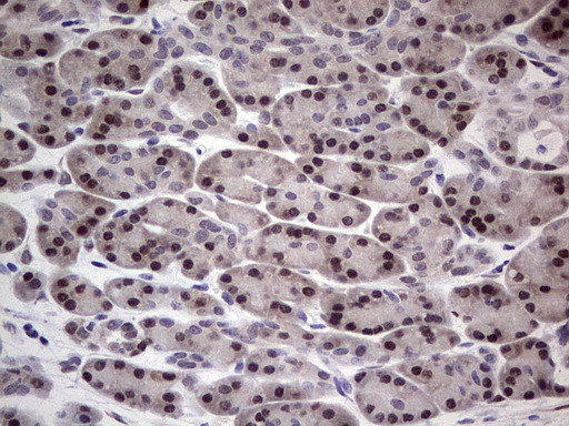 RAD23B Antibody in Immunohistochemistry (Paraffin) (IHC (P))