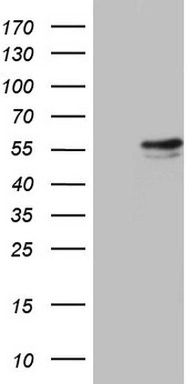 RAD23B Antibody in Western Blot (WB)