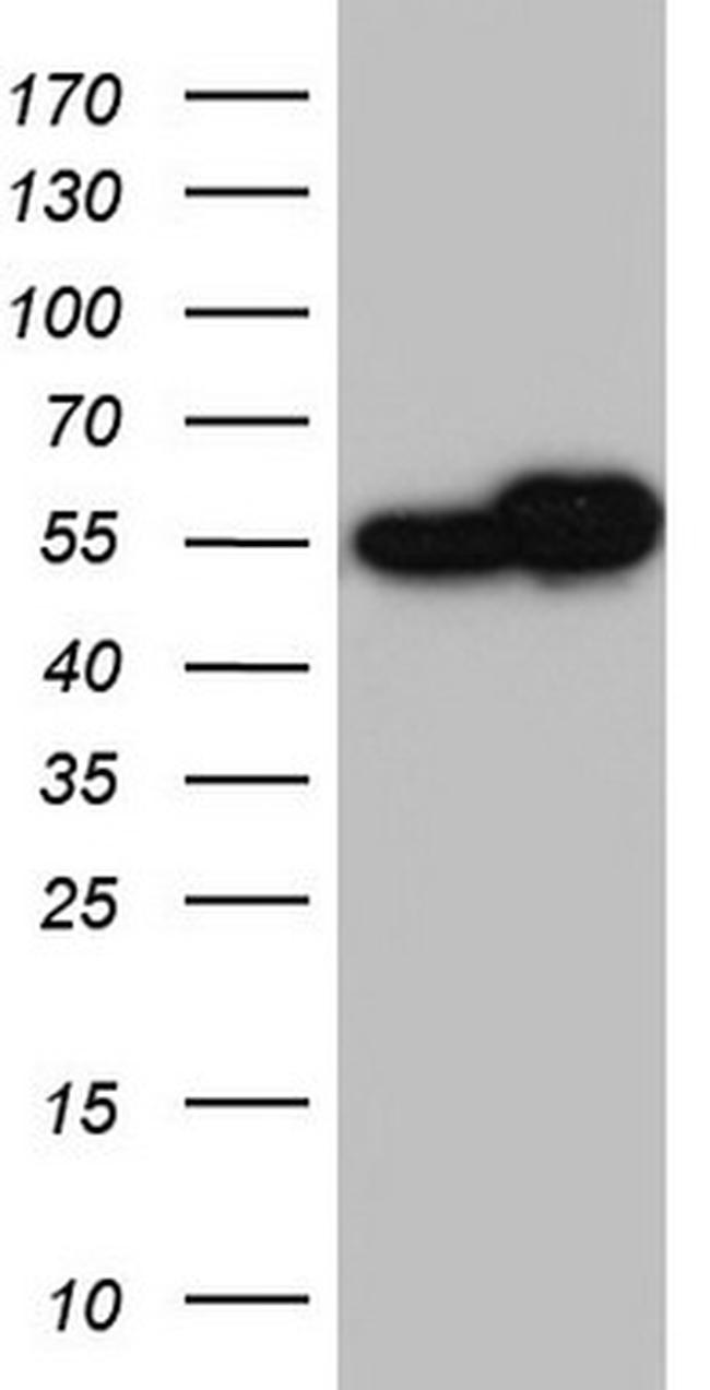 RAD23B Antibody in Western Blot (WB)