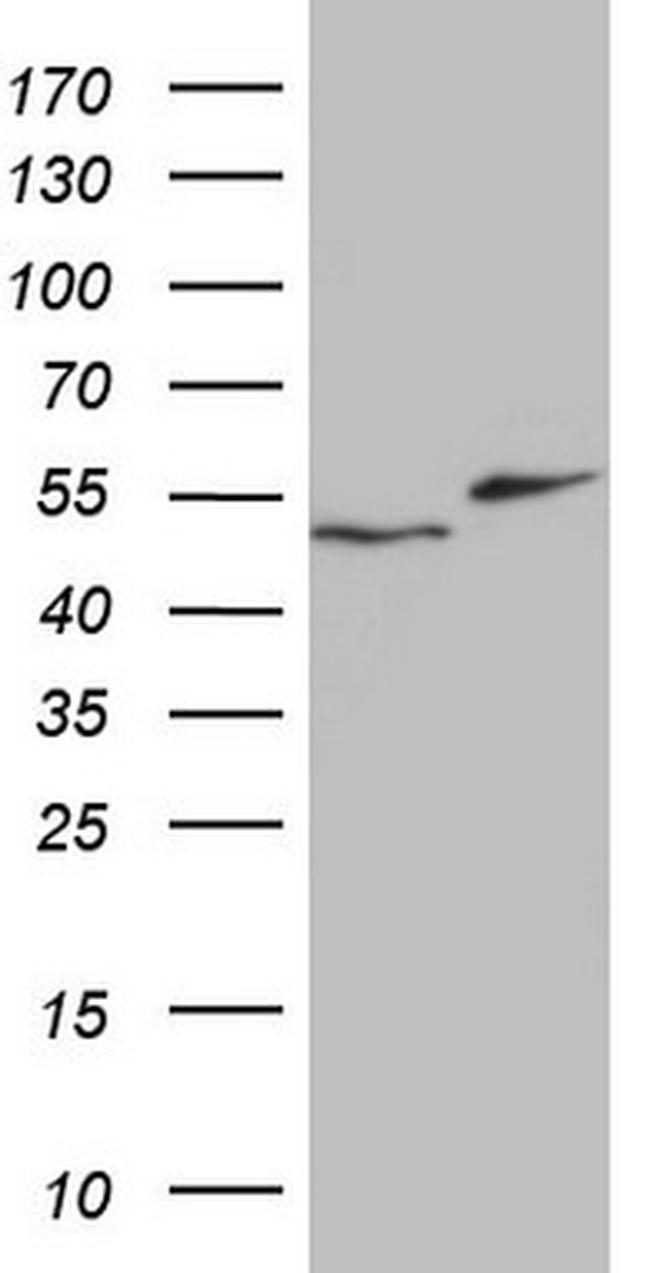 RAD23B Antibody in Western Blot (WB)