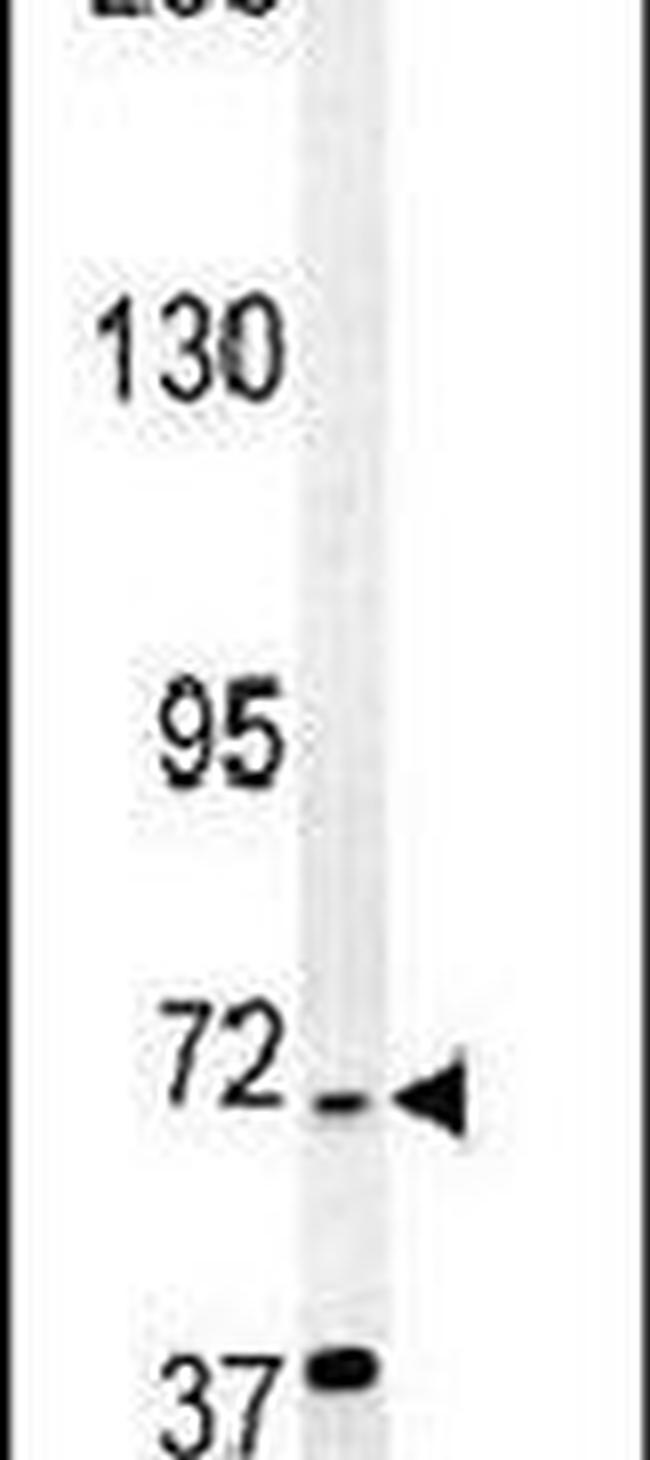 RAD26L Antibody in Western Blot (WB)