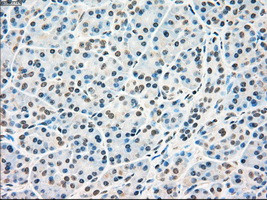 RAD9A Antibody in Immunohistochemistry (Paraffin) (IHC (P))