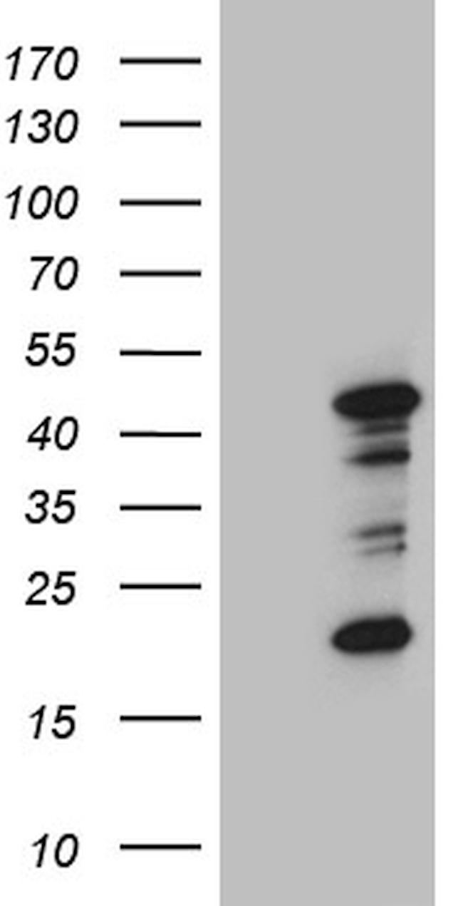 RAGE Antibody in Western Blot (WB)