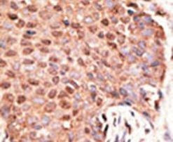 ZMIZ1 Antibody in Immunohistochemistry (IHC)