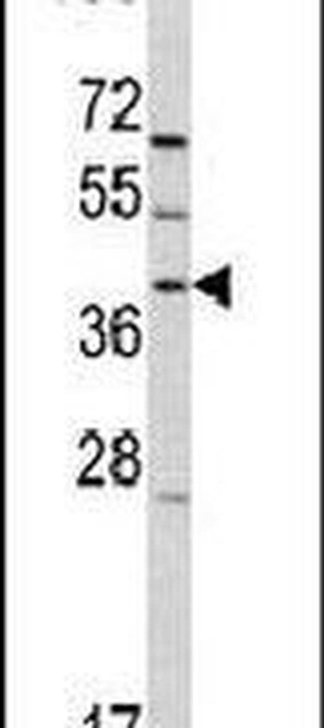 RAI3 Antibody in Western Blot (WB)