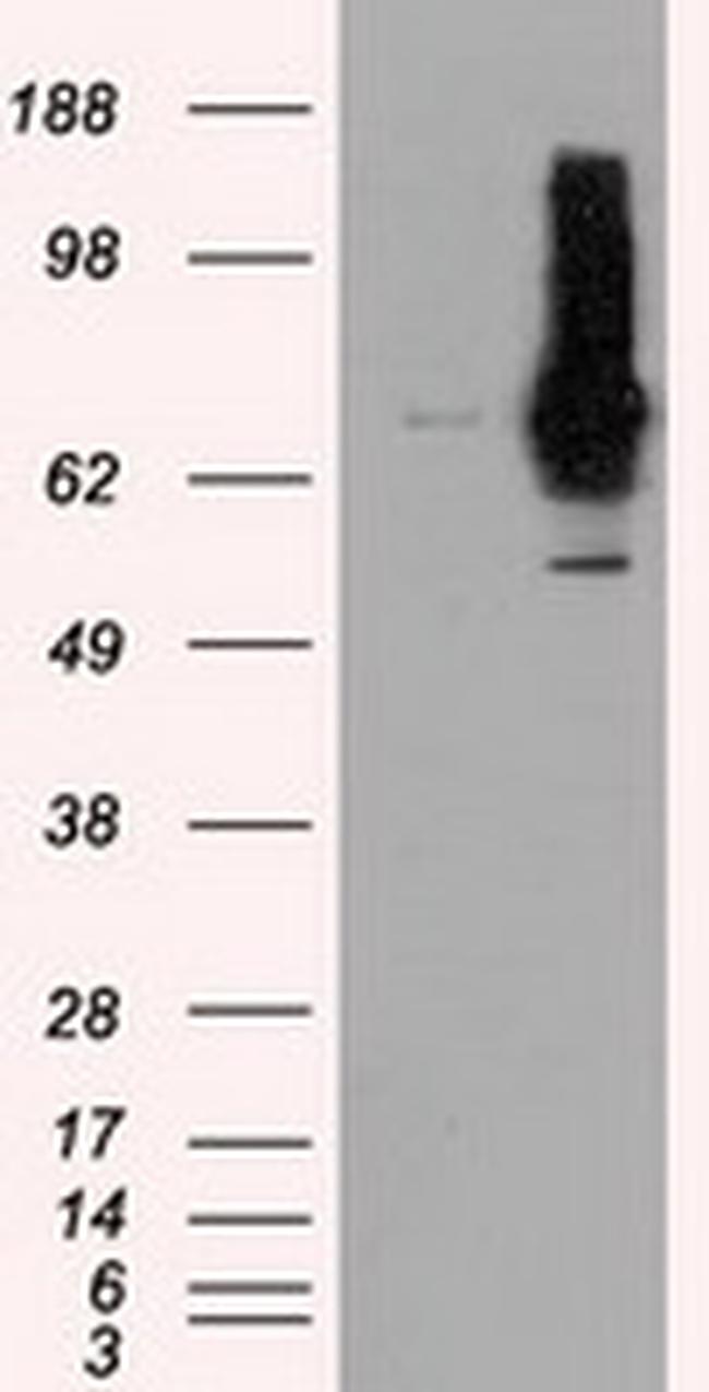 RALBP1 Antibody in Western Blot (WB)