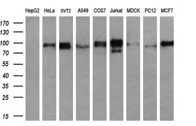 RALBP1 Antibody in Western Blot (WB)