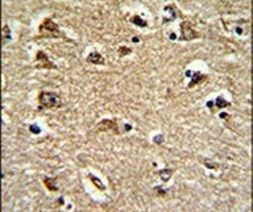 RAN Antibody in Immunohistochemistry (IHC)