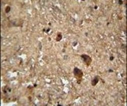 RAN Antibody in Immunohistochemistry (IHC)