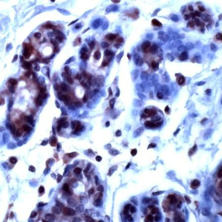 RAN Antibody in Immunohistochemistry (IHC)