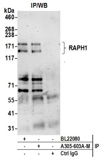 RAPH1 Antibody in Immunoprecipitation (IP)