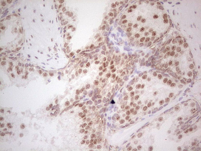 RARA Antibody in Immunohistochemistry (Paraffin) (IHC (P))
