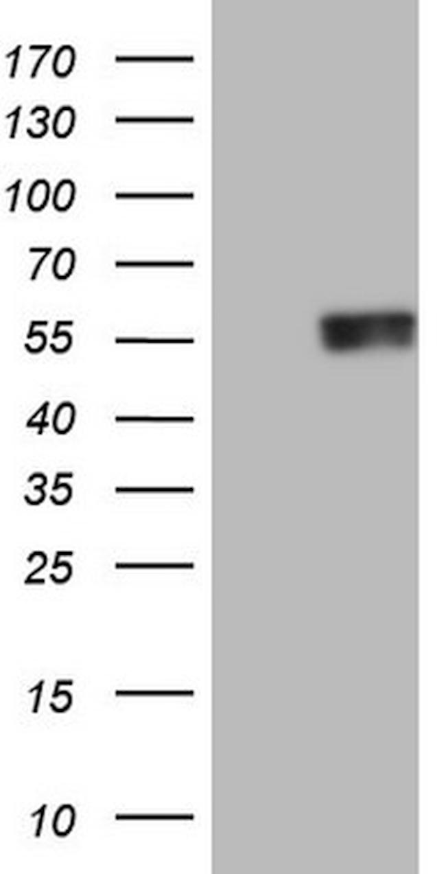 RARA Antibody in Western Blot (WB)