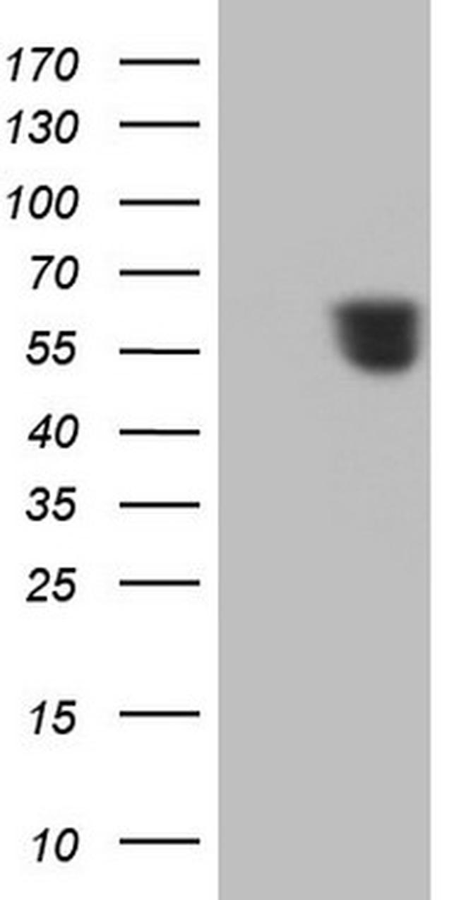 RARA Antibody in Western Blot (WB)